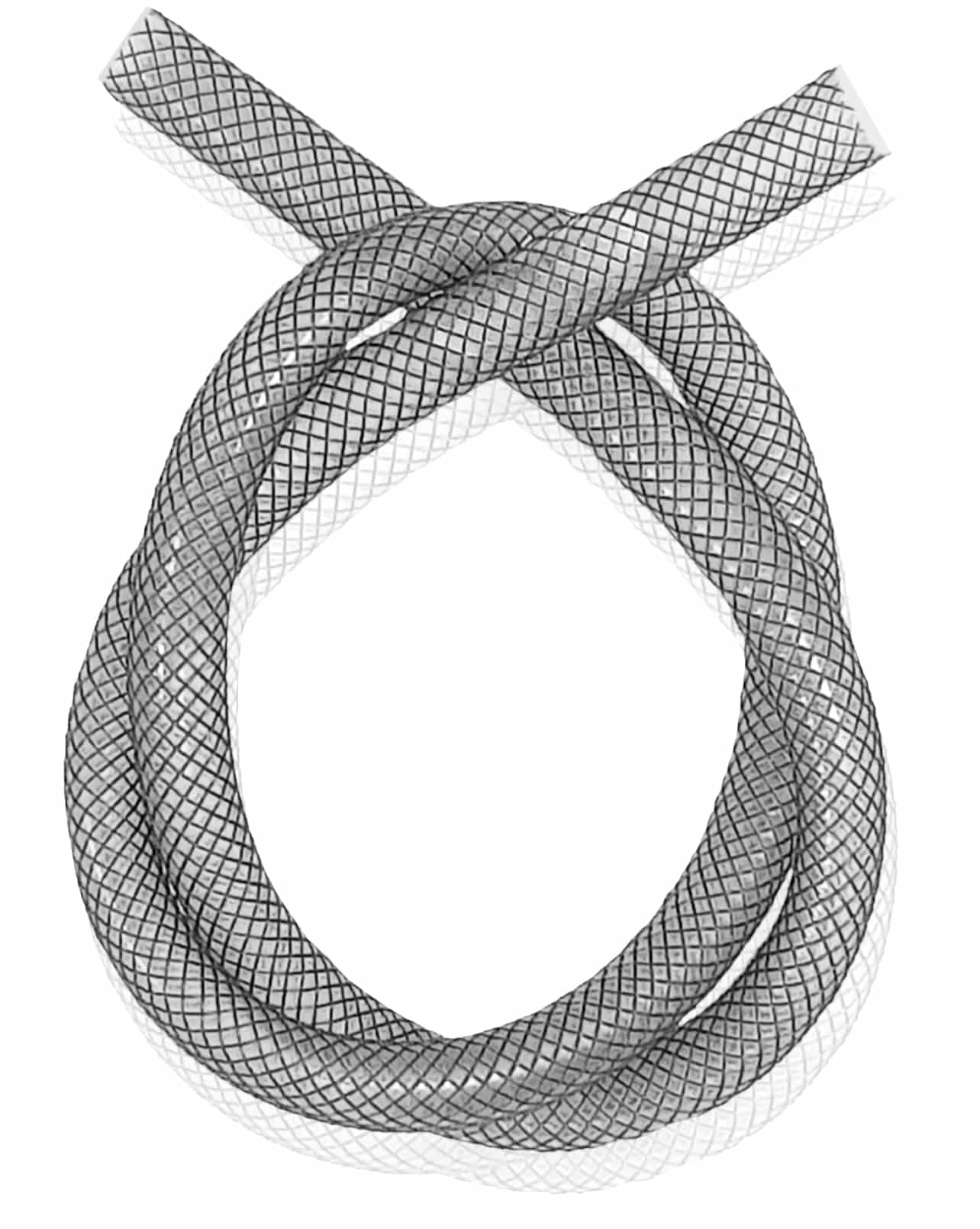 High precision coating for nitinol braided stent High precision coating for nitinol braided stent