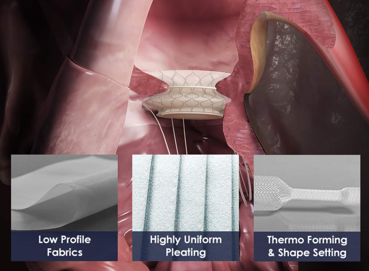 Low Profile Sutureless Heart Valve Covers