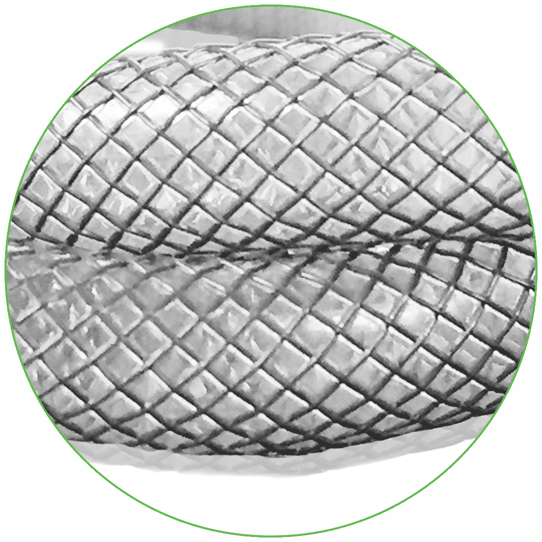 High precision coatings for braided medical devices Elastomeric Braid Coating