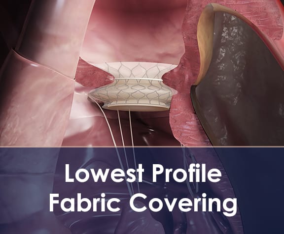 Low Profile Fabric Coverings for Mitral, Aortic and other Structural Heart Valves