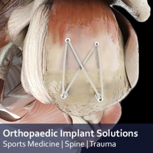 Orthopaedic contract manufacturing solutions - anchors, screws, sutures, resorbable implants, scaffolds