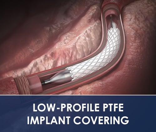 LOW-PROFILE PTFE IMPLANT COVERING LOW-PROFILE PTFE IMPLANT COVERING