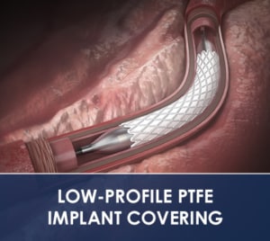 LOW-PROFILE PTFE IMPLANT COVERING