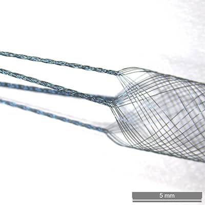 Quadfurcated Nitinol Braid